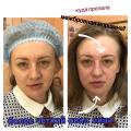 Корректирующий массаж лица