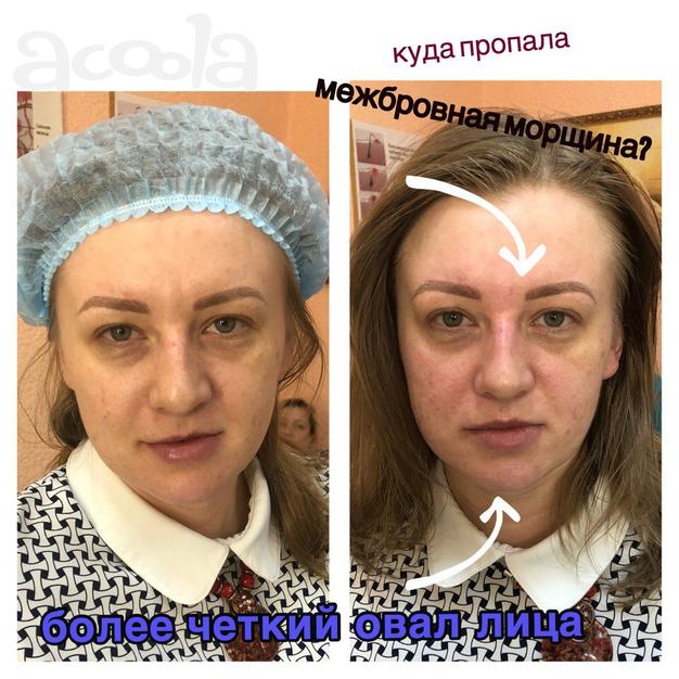 Корректирующий массаж лица